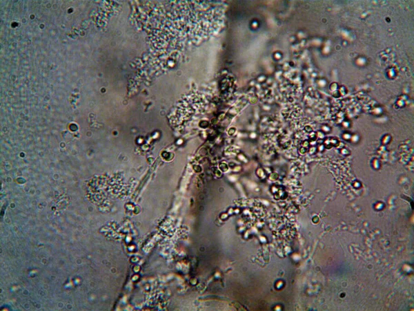 더러운 미생물들 싱크대 아래에 — 스톡 사진