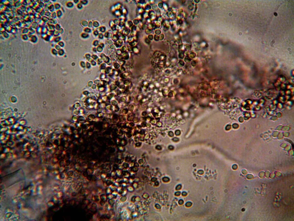 Мікроорганізм Живе Брудній Воді Під Мийкою — стокове фото