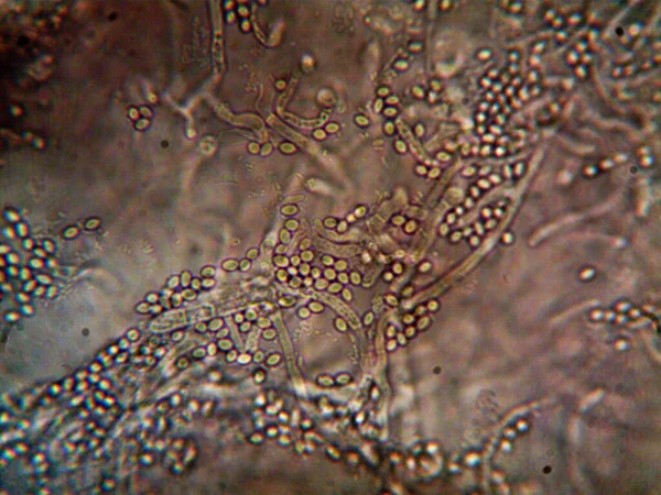 Micro Organisme Leeft Vuil Water Onder Mijn Gootsteen — Stockfoto