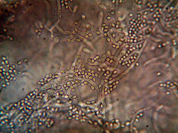 汚れた水に住む微生物は私のシンクの下に — ストック写真