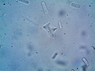 Mikroskop, kirli su ve bulduğum tüm organizmalar.