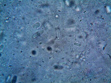 Mikroskop, kirli su ve bulduğum tüm organizmalar.