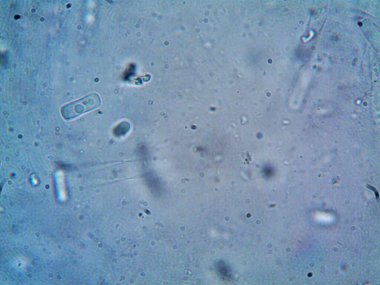 Mikroskop, kirli su ve bulduğum tüm organizmalar.