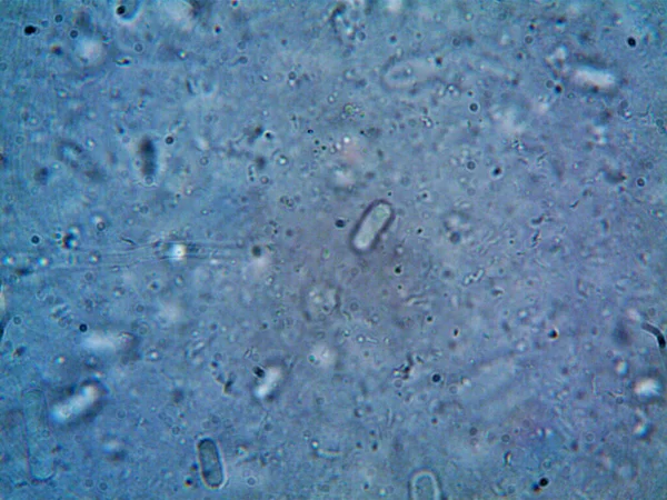 Microscopio Agua Sucia Todo Organismo Que Encontré — Foto de Stock