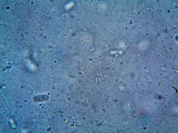 Mikroskop, kirli su ve bulduğum tüm organizmalar.