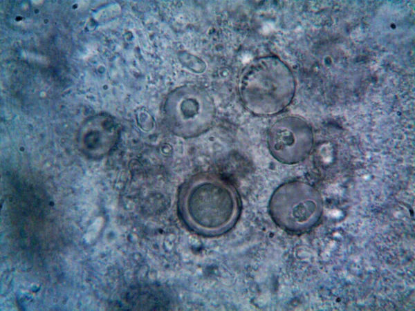 顕微鏡や汚れた水そして見つけた全ての生物は — ストック写真