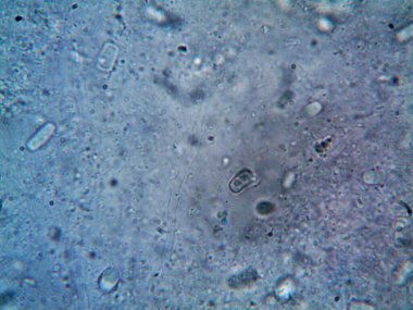 Mikroskop, kirli su ve bulduğum tüm organizmalar.