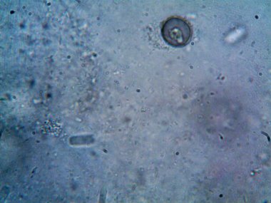 Mikroskop, kirli su ve bulduğum tüm organizmalar.