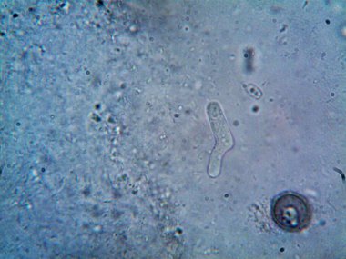 Mikroskop, kirli su ve bulduğum tüm organizmalar.