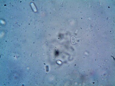 Mikroskop, kirli su ve bulduğum tüm organizmalar.