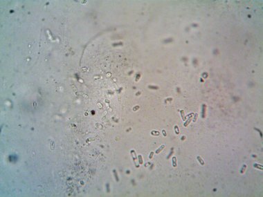 Mikroskop, kirli su ve bulduğum tüm organizmalar.