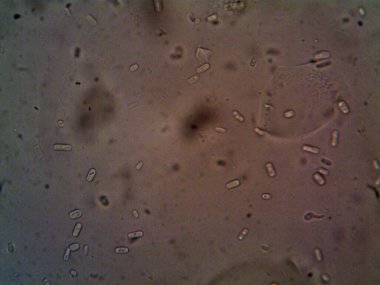 Mikroskop, kirli su ve bulduğum tüm organizmalar.