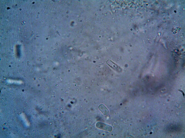 Microscopio Agua Sucia Todo Organismo Que Encontré —  Fotos de Stock