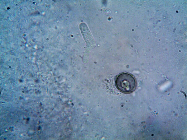 Microscopio Agua Sucia Todo Organismo Que Encontré —  Fotos de Stock