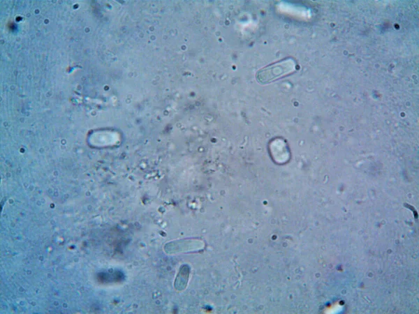 Mikroskop Smutsigt Vatten Och Alla Organismer Jag Hittade — Stockfoto