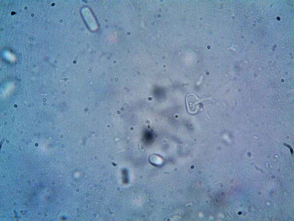 Микроскоп Грязная Вода Организм Который Нашел — стоковое фото