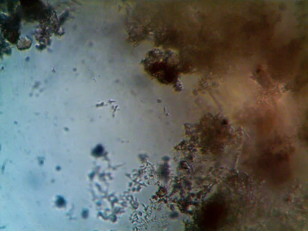 Microscopio Agua Sucia Todo Organismo Que Encontré — Foto de Stock