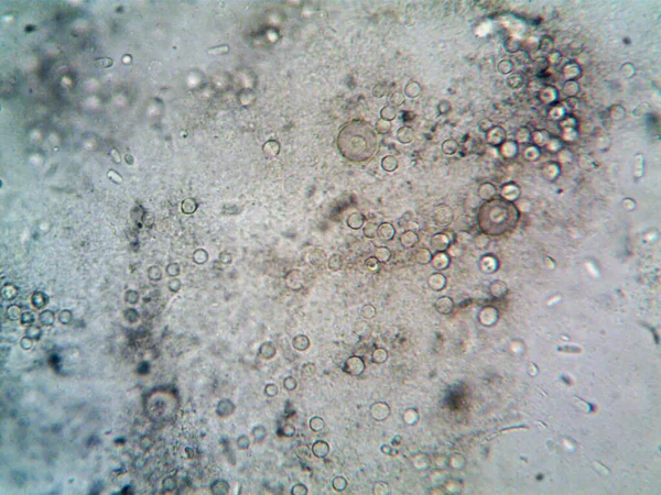 Mikroskop Smutsigt Vatten Och Alla Organismer Jag Hittade — Stockfoto