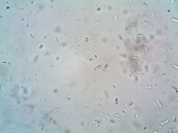 Μικροσκόπιο Βρώμικο Νερό Και Κάθε Οργανισμό Που Βρήκα — Φωτογραφία Αρχείου