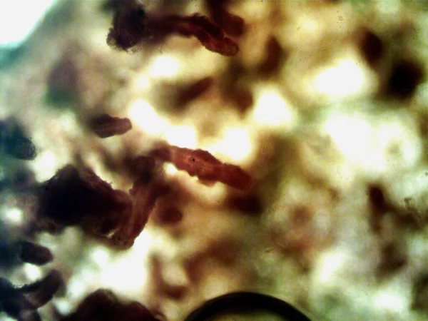 Mikroskop Schmutzwasser Und Alle Gefundenen Organismen — Stockfoto