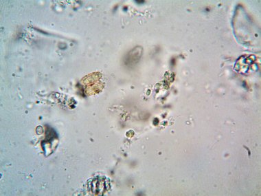 Mikroskop, kirli su ve bulduğum tüm organizmalar.