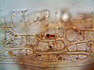 Mikroskop, kirli su ve bulduğum tüm organizmalar.