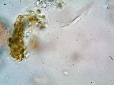 Mikroskop, kirli su ve bulduğum tüm organizmalar.