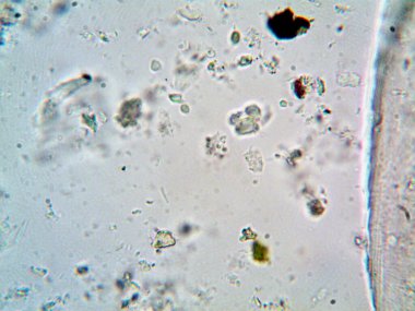 Lavabonun altındaki kirli suyun bakteri fotoğrafları.