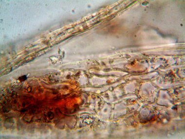 Lavabonun altındaki kirli suyun bakteri fotoğrafları.