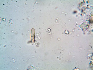 Lavabonun altındaki kirli suyun bakteri fotoğrafları.