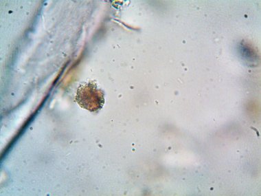 Lavabonun altındaki kirli suyun bakteri fotoğrafları.