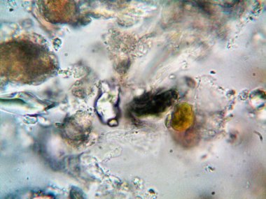 Lavabonun altındaki kirli suyun bakteri fotoğrafları.