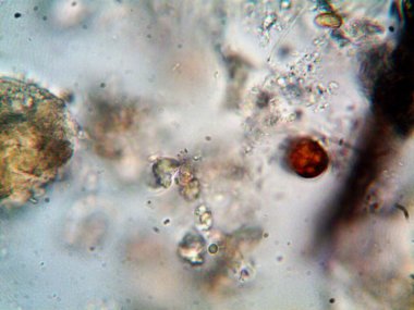 Lavabonun altındaki kirli suyun bakteri fotoğrafları.