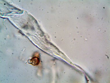 Lavabonun altındaki kirli suyun bakteri fotoğrafları.