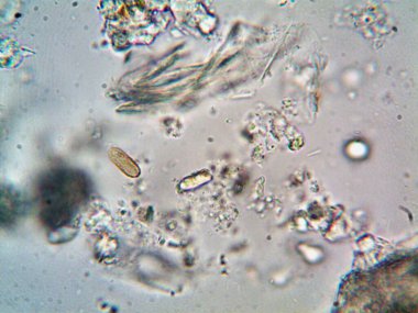 Lavabonun altındaki kirli suyun bakteri fotoğrafları.