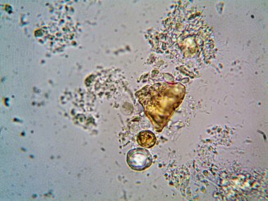 Lavabonun altındaki kirli suyun bakteri fotoğrafları.