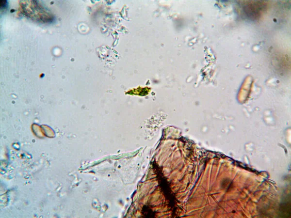 シンクの下の汚れた水からの細菌の写真 — ストック写真