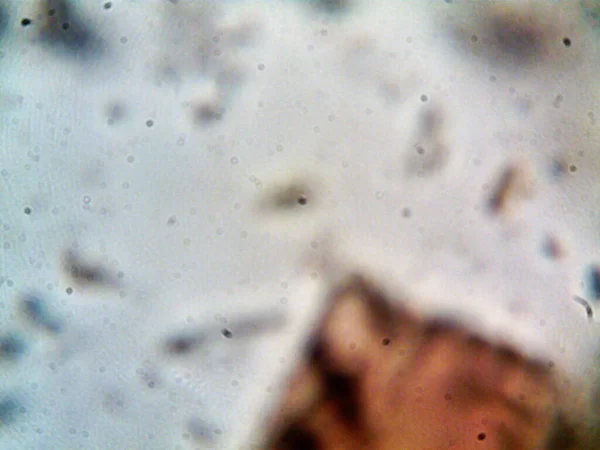 Фото Бактерій Брудної Води Під Раковиною — стокове фото