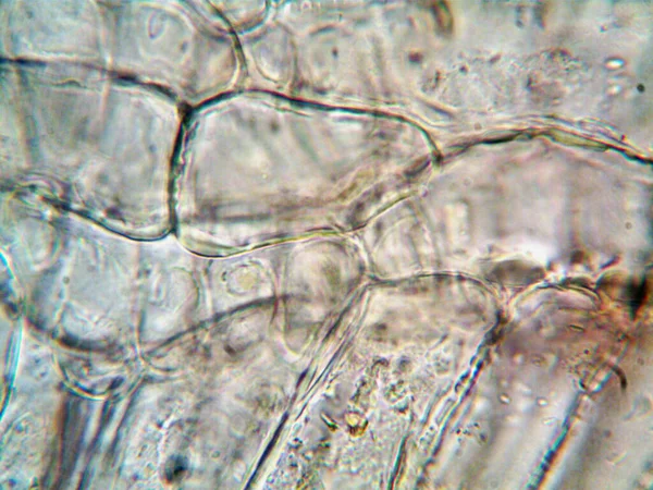 Lavabonun altındaki kirli suyun bakteri fotoğrafları.