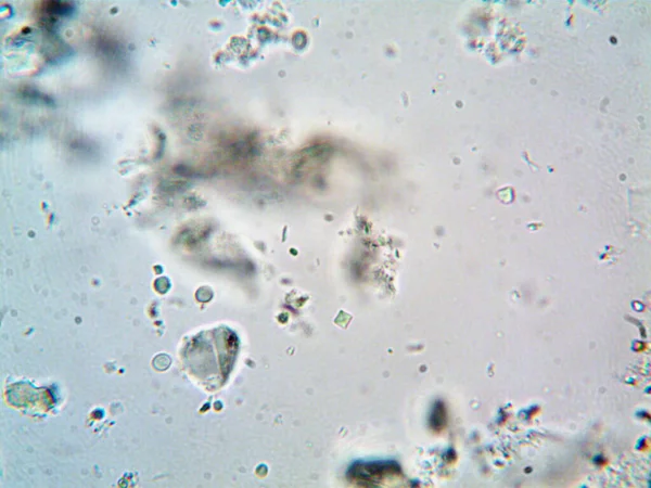 Lavabonun altındaki kirli suyun bakteri fotoğrafları.