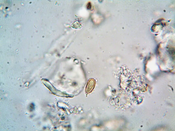 Foto Van Bacteriën Uit Vuil Water Onder Gootsteen — Stockfoto