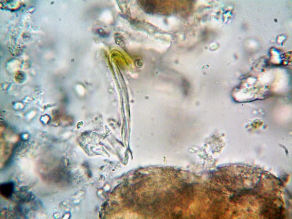 Fotos Von Bakterien Aus Schmutzwasser Unter Waschbecken — Stockfoto