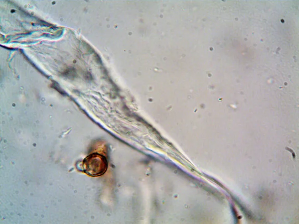 Lavabonun altındaki kirli suyun bakteri fotoğrafları.