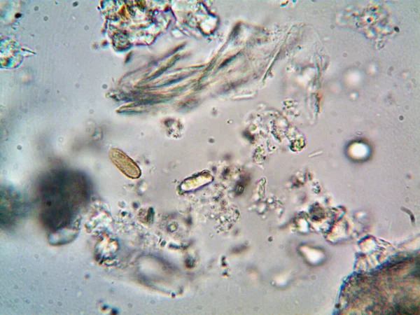 Lavabonun altındaki kirli suyun bakteri fotoğrafları.