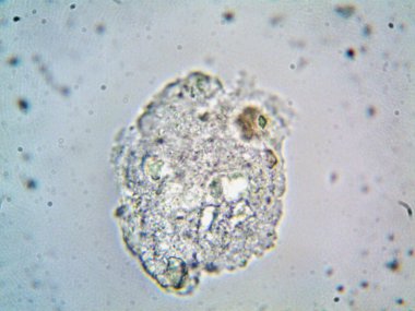 Lavabonun altındaki kirli suyun bakteri fotoğrafları.