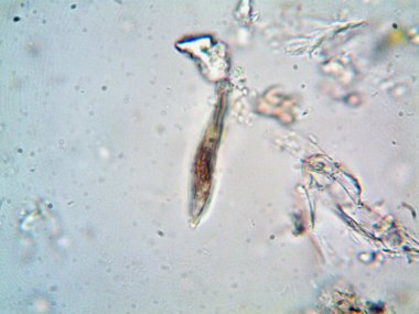 Lavabonun altındaki kirli suyun bakteri fotoğrafları.