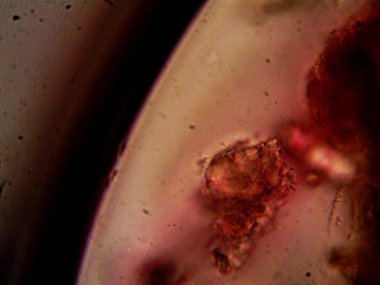 Lavabonun altındaki kirli suyun bakteri fotoğrafları.