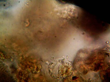 Lavabonun altındaki kirli suyun bakteri fotoğrafları.