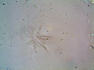 Lavabonun altındaki kirli suyun bakteri fotoğrafları.