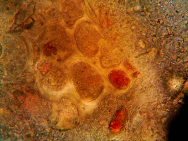 Lavabonun altındaki kirli suyun bakteri fotoğrafları.